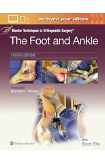 Master Techniques in Orthopaedic Surgery