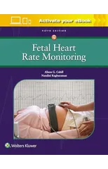 Fetal Heart Rate Monitoring