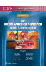 The Direct Anterior Approach to Hip Reconstruction