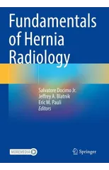 Fundamentals of Hernia Radiology
