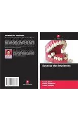 Sucesso dos implantes