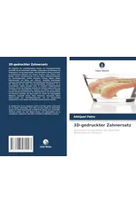 3D-gedruckter Zahnersatz