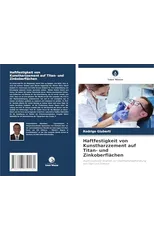 Haftfestigkeit von Kunstharzzement auf Titan- und Zinkoberflachen