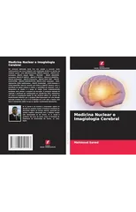 Medicina Nuclear e Imagiologia Cerebral