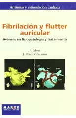 Fibrilacion y flutter auricular