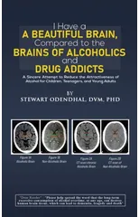 I Have a Beautiful Brain, Compared to the Brains of Alcoholics and Drug Addicts