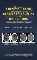 I Have a Beautiful Brain, Compared to the Brains of Alcoholics and Drug Addicts