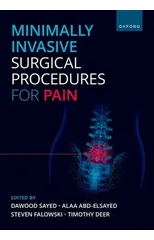 Minimally Invasive Surgical Procedures for Pain