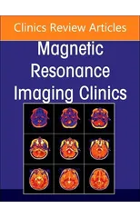 MR Imaging of the Hip, An Issue of Magnetic Resonance Imaging Clinics of North America