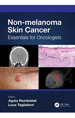 Non-melanoma Skin Cancer