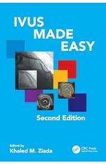 IVUS Made Easy