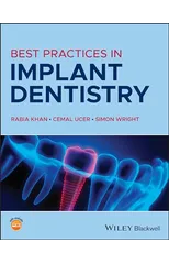 Best Practices in Implant Dentistry