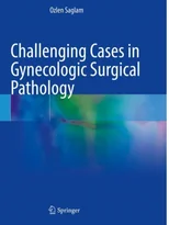 Challenging Cases in Gynecologic Surgical Pathology