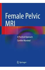 Female Pelvic MRI