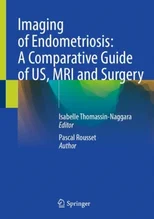 Imaging of Endometriosis