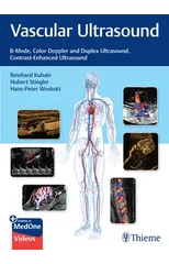 Vascular Ultrasound