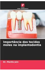 Importancia dos tecidos moles na implantodontia