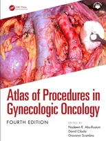 Atlas of Procedures in Gynecologic Oncology