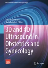 3D and 4D Ultrasound in Obstetrics and Gynecology